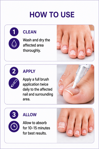 Kavello Antifungal Nail Treatment Pen
