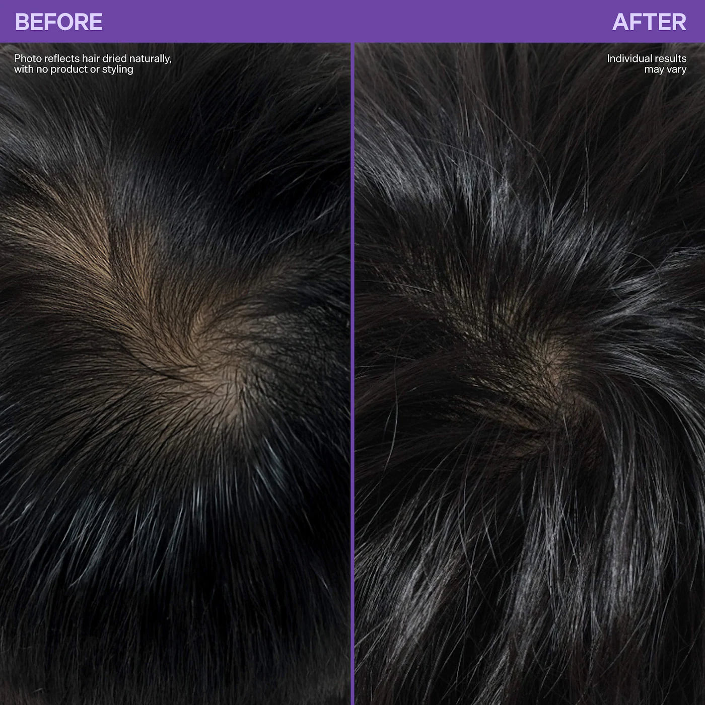 Kavello Scalp Revitalizing Roller Serum