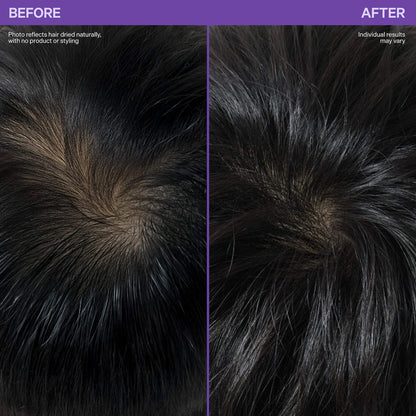 Kavello Scalp Revitalizing Roller Serum